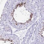 MON1A Antibody in Immunohistochemistry (Paraffin) (IHC (P))