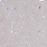 CENPT Antibody in Immunohistochemistry (Paraffin) (IHC (P))