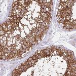 REEP1 Polyclonal Antibody