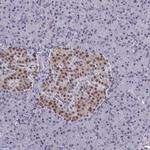 BCL7B Polyclonal Antibody