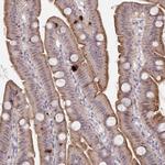 PRSS33 Polyclonal Antibody