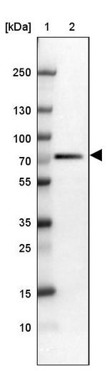 RBBP5 Antibody in Western Blot (WB)