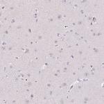 TMEM52B Antibody in Immunohistochemistry (Paraffin) (IHC (P))