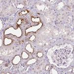 TMEM52B Antibody in Immunohistochemistry (Paraffin) (IHC (P))