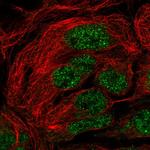 SH3RF2 Polyclonal Antibody