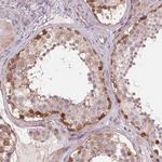SH3RF2 Antibody in Immunohistochemistry (Paraffin) (IHC (P))