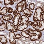 CHDH Antibody in Immunohistochemistry (Paraffin) (IHC (P))