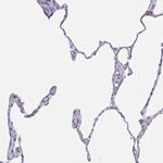 CHDH Antibody in Immunohistochemistry (IHC)
