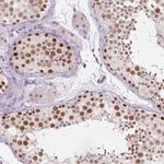 FAM53A Polyclonal Antibody