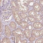 C10orf128 Antibody in Immunohistochemistry (Paraffin) (IHC (P))
