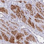 MOCS1 Antibody in Immunohistochemistry (Paraffin) (IHC (P))