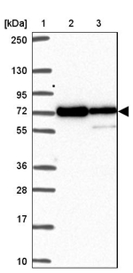 MOCS1 Antibody in Western Blot (WB)