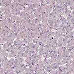 DNAH12 Polyclonal Antibody