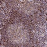 SLC9A9 Polyclonal Antibody