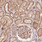 TSPAN12 Antibody in Immunohistochemistry (Paraffin) (IHC (P))