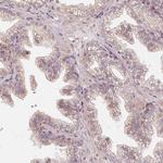 TSPAN12 Antibody in Immunohistochemistry (Paraffin) (IHC (P))