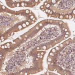 TSPAN12 Antibody in Immunohistochemistry (Paraffin) (IHC (P))
