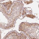 TSPAN12 Antibody in Immunohistochemistry (Paraffin) (IHC (P))
