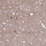 NUMBL Antibody in Immunohistochemistry (IHC)