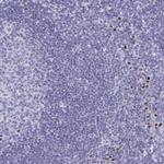 MCAR1 Polyclonal Antibody