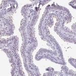 C20orf85 Antibody in Immunohistochemistry (IHC)