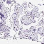 C20orf85 Antibody in Immunohistochemistry (IHC)