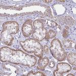 BBS1 Polyclonal Antibody