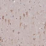 B4GALT6 Antibody in Immunohistochemistry (Paraffin) (IHC (P))