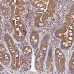 B4GALT6 Polyclonal Antibody