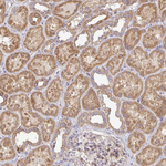 B4GALT6 Antibody in Immunohistochemistry (Paraffin) (IHC (P))
