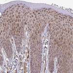 B4GALT6 Antibody in Immunohistochemistry (Paraffin) (IHC (P))