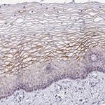 SUSD4 Antibody in Immunohistochemistry (IHC)