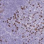 CDADC1 Polyclonal Antibody