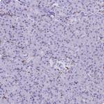LIMS2 Antibody in Immunohistochemistry (Paraffin) (IHC (P))