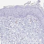 LIMS2 Antibody in Immunohistochemistry (Paraffin) (IHC (P))