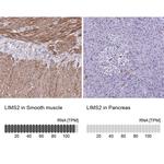 LIMS2 Antibody in Immunohistochemistry (IHC)