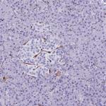 LIMS2 Antibody in Immunohistochemistry (IHC)