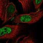 CCDC85C Polyclonal Antibody