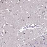CCDC85C Antibody in Immunohistochemistry (Paraffin) (IHC (P))