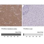 TTC7B Polyclonal Antibody