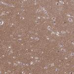 TTC7B Antibody in Immunohistochemistry (IHC)