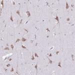RPL7 Antibody in Immunohistochemistry (Paraffin) (IHC (P))