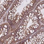 RPL7 Antibody in Immunohistochemistry (Paraffin) (IHC (P))