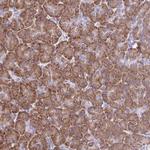 RPL7 Antibody in Immunohistochemistry (Paraffin) (IHC (P))