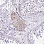 RPL7 Antibody in Immunohistochemistry (Paraffin) (IHC (P))