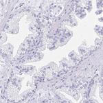SNTN Antibody in Immunohistochemistry (IHC)