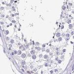 SNTN Antibody in Immunohistochemistry (IHC)