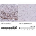 DDB2 Antibody in Immunohistochemistry (IHC)