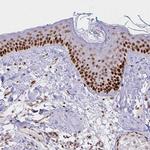 DDB2 Antibody in Immunohistochemistry (IHC)