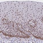 DDB2 Antibody in Immunohistochemistry (IHC)